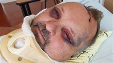 Zraněný předseda poslanců Komunistické strany Čech a Moravy Pavel Kováčik Zraněný předseda poslanců Komunistické strany Čech a Moravy Pavel Kováčik