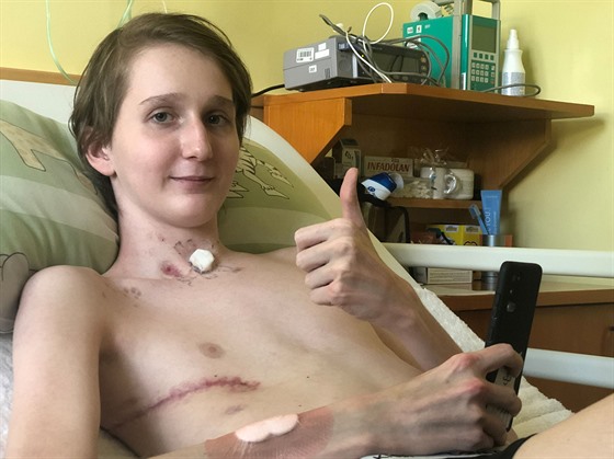 Patnáctiletý Nikolas tém piel o ivot, kdy jej napadl vzácný stafylokok.