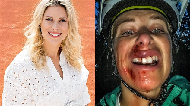 Andrea Sestini Hlaváčková měla nehodu na kole Andrea Sestini Hlaváčková měla nehodu na kole