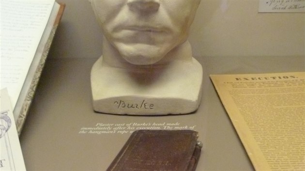 Burkeho tlo se po jeho odsouzen a poprav stalo samo pedmtem veejn pitvy. A kneka vzan v jeho ki je dnes v edinburghskm muzeu chirurgie.