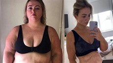 Leah Punchová dříve a pár týdnů po operaci žaludku Leah Punchová dříve a pár týdnů po operaci žaludku