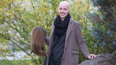 Ticetiletá Tereza Drahoovská trpí alopecií. S nemocí se rozhodla bojovat....