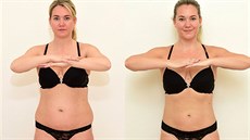 O 2 velikosti. Konečně upřímná reportáž na téma liposukce O 2 velikosti. Konečně upřímná reportáž na téma liposukce
