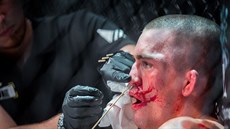 Ranhojič MMA bojovníků: Hlídáme i to, aby si nemáčeli rukavice v čpavku Ranhojič MMA bojovníků: Hlídáme i to, aby si nemáčeli rukavice v čpavku