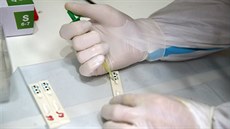 Antigenní testování pro občany zdarma v brněnské společnosti Podané ruce. (16.... Antigenní testování pro občany zdarma v brněnské společnosti Podané ruce. (16....