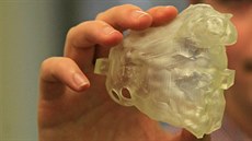 Jan Hečko s 3D modelem srdce, který pomáhá v nemocnici AGEL v Třinci-Podlesí. Jan Hečko s 3D modelem srdce, který pomáhá v nemocnici AGEL v Třinci-Podlesí.