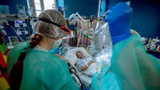 Kyslík se do dýchacích cest pacientů dodává ve vysoké koncentraci pod tlakem.... Kyslík se do dýchacích cest pacientů dodává ve vysoké koncentraci pod tlakem....
