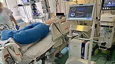 Elektrická impedaní tomografie (EIT) monitoruje pacienta.