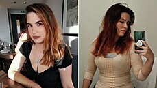 Kvůli operaci cestovala žena až do Mexika. Kvůli operaci cestovala žena až do Mexika.