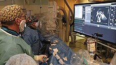 Dvě a půl hodiny trvala výjimečná operace lékařů ústecké kardiologické kliniky.... Dvě a půl hodiny trvala výjimečná operace lékařů ústecké kardiologické kliniky....