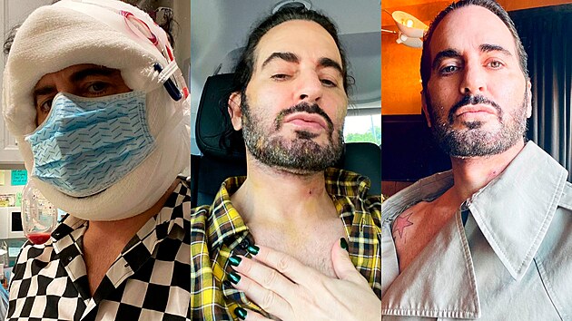 Marc Jacobs sdl na Instagramu s pznivci i neretuovan fotografie ze ivota. (2021)