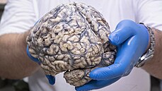 V zařízení Brain Bank se připravují a uchovávají vzorky lidské tkáně, hlavně... V zařízení Brain Bank se připravují a uchovávají vzorky lidské tkáně, hlavně...
