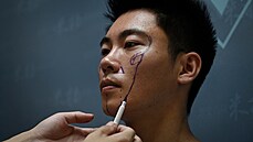 Vědecký výzkumník Xia Shurong před plastickou operací na chirurgické klinice v... Vědecký výzkumník Xia Shurong před plastickou operací na chirurgické klinice v...