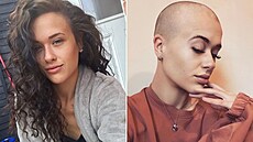 Charlotte Collinsová před rokem a dnes. Charlotte Collinsová před rokem a dnes.
