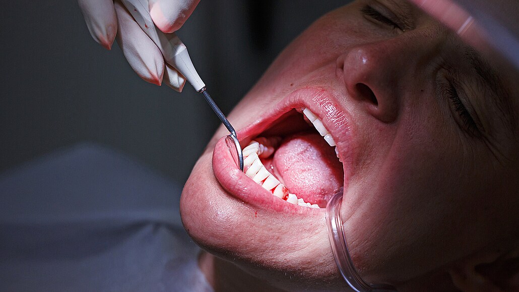 Zántem dásní (gingivitidou) trpí pes 80 % lidí, a kdy není vas...
