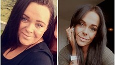 Jade Wilkinsonová zhubla přes čtyřicet kilogramů. Jade Wilkinsonová zhubla přes čtyřicet kilogramů.