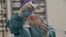 Lékai praského IKEM transplantují jednomu z pacient ledvinu, která...