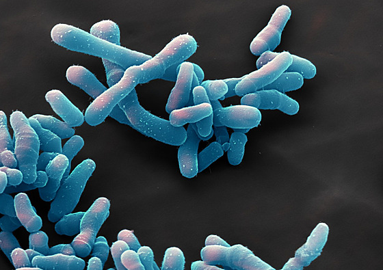 Bakterie Corynebacterium diphteriae, pvodce onemocnní zákrtu