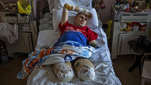 Anton, 22let vojensk zdravotnk nasazen v pednch linich na vchodn Ukrajin, piel o ob nohy a levou ruku pi vbuchu miny 27. bezna. (5. kvtna 2022)