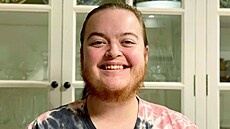 Morgan Colemanová má na tváři vousy jako muž. Morgan Colemanová má na tváři vousy jako muž.