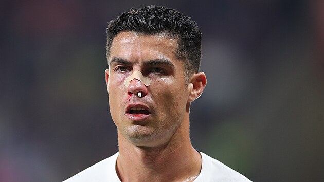 Cristiano Ronaldo po stetu s Tomem Vaclkem v utkn Ligy nrod.