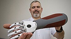 Protetik Tomá Tykal ukazuje myoelektrickou protézu ruky se zevním lkem,...