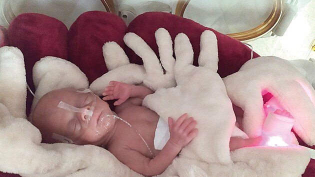 Předčasně narozená Vanesa se stala nejmenším novorozencem, o jakého kdy v olomoucké fakultní nemocnici pečovali.