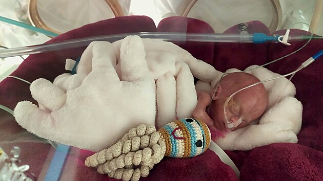Předčasně narozená Vanesa se stala nejmenším novorozencem, o jakého kdy v olomoucké fakultní nemocnici pečovali.