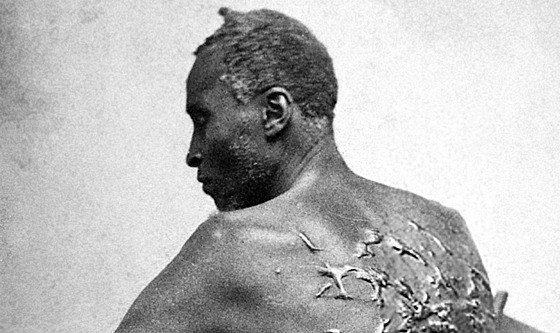 Slavná fotografie otroka Gordona, na ní ukazuje jizvy, které mu na zádech...