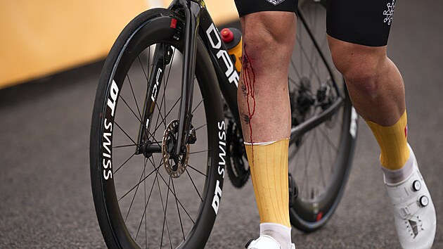 Krvcejc noha norskho cyklisty Torsteina Traeena (Uno-X) po pdu ve tvrt etap Tour de France