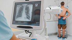 Honem. Plné ekárny nutí pracovníky radiodiagnostických center zrychlit. Na...