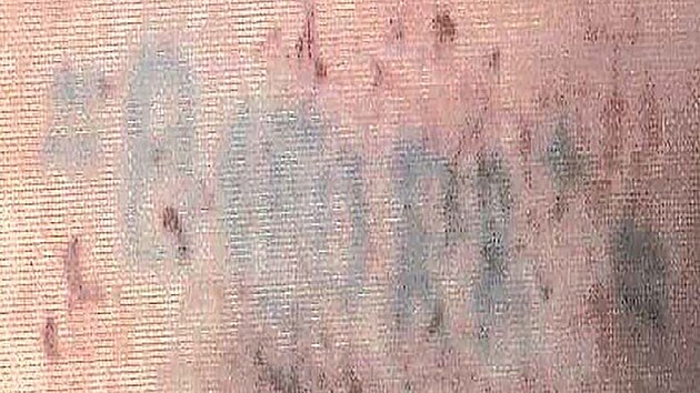 Policie pátrá po totožnosti neznámého muže, který byl obětí trestného činu v prosinci 2004