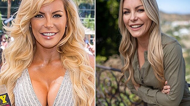 O toxicitě silikonových implantátů nejčastěji veřejně hovoří bývalá modelka Crystal Hefnerová. „Málokdo to chce slyšet, ale implantáty jsou jed. Kéž bych to věděla dřív. Ušetřila bych si tolik trápení. A ne, vaši ženskost neurčují implantáty. Ženy jsou krásné takové, jaké jsou,“ svěřila se.
