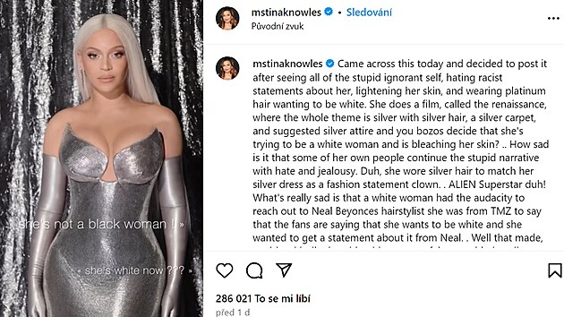 Tina Knowlesová hájí světlý vzhled své dcery Beyoncé.