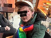 Napadený muž skončil po útoku s tržnými ranami na hlavě. Napadený muž skončil po útoku s tržnými ranami na hlavě.
