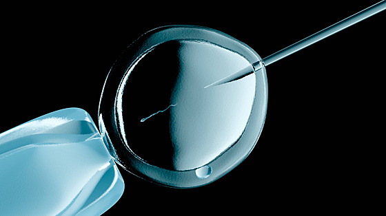 Umlé oplodnní vajíka spermií. Ilustraní foto.