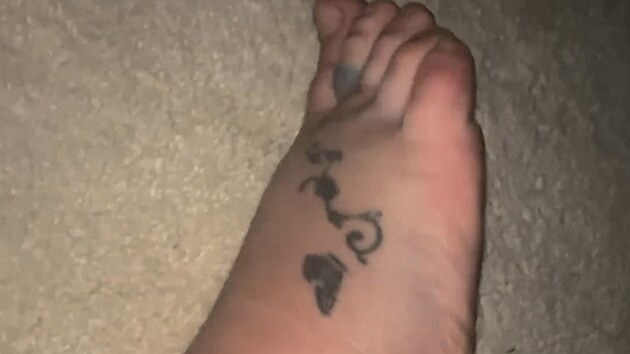 Britney Spears zveřejnila snímek své poraněné nohy po incidentu v hotelu Chateau Marmont v Los Angeles (květen 2024)