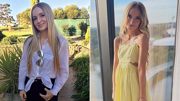 Žena kvůli své nemoci už zažila hodně trápení.