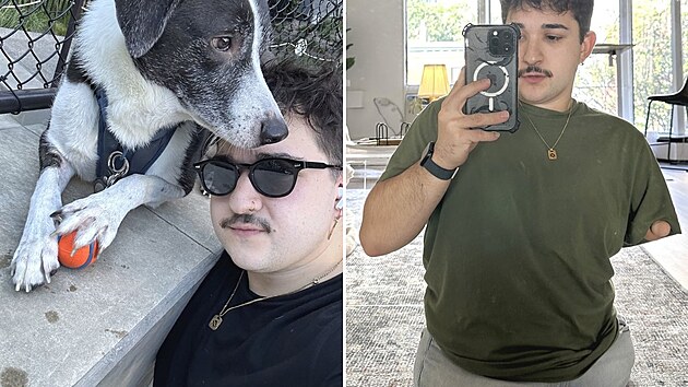 Tim je i přes svůj hendikep neuvěřitelně pozitivní a jde ostatním příkladem.