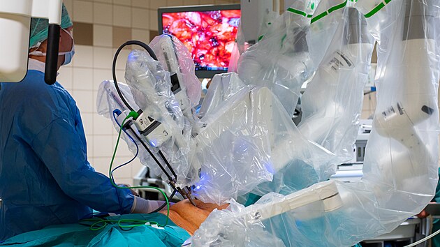 Olomoucká fakultní nemocnice využívá při operacích nejnovější generaci víceramenného laparoskopického operačního systému da Vinci. Lékař při ní operuje pomocí joysticku.