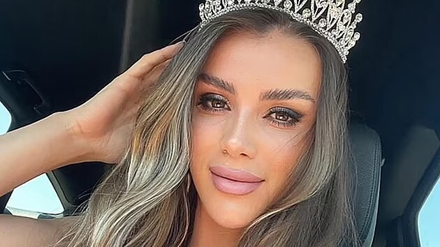 Miss Europe-Kosovo Guler Erdoganová tragicky zemřela ve 27 letech. (duben 2025) Miss Europe-Kosovo Guler Erdoganová tragicky zemřela ve 27 letech. (duben 2025)