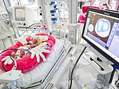 Nový přístroj, který ve zlínské porodnici pomáhá s monitorováním dechových... Nový přístroj, který ve zlínské porodnici pomáhá s monitorováním dechových...