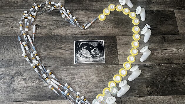 Toto vše může být třeba při cestě za vysněným miminkem. Foto od klientky