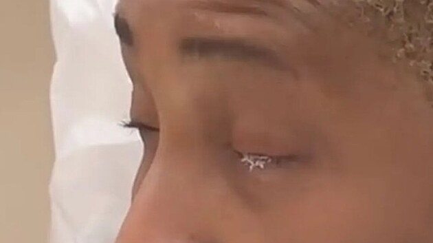 Místo očních kapek lepidlo