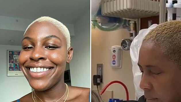 Kvůli nepozornosti měla žena velké zdravotní obtíže.