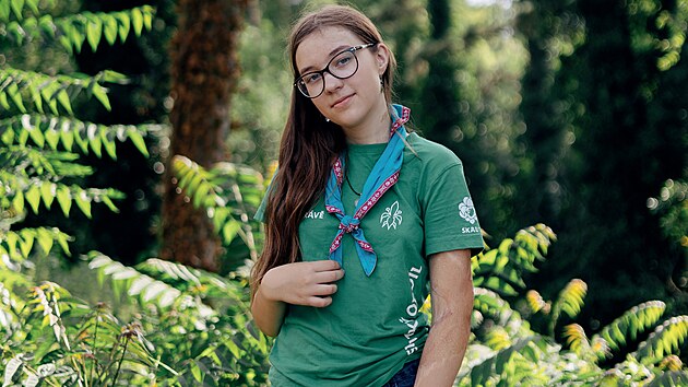 Tamara na sebe v necelých dvou letech převrhla hrnek s horkým čajem, který jí způsobil popáleniny 2. a 3. stupně na patnácti procentech těla. I její příběh je součástí putovní výstavy.