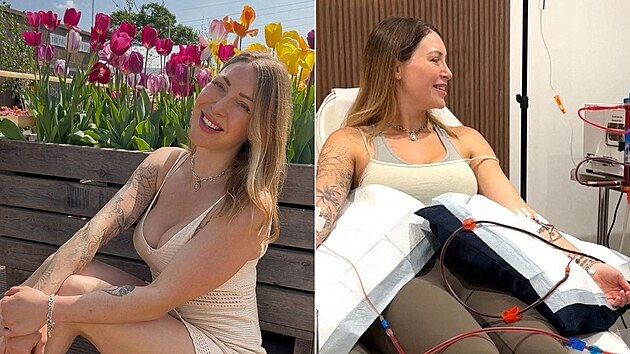 Počínání ženy je bizarní, ale prý skvěle funguje a doporučuje ho všem, přestože se jedná o nákladnější záležitost.