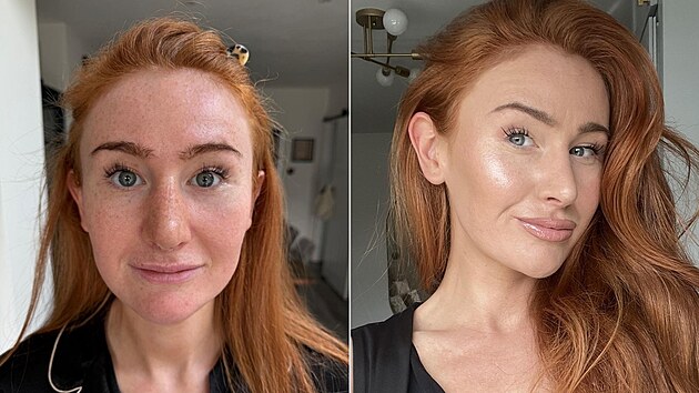 Žena má z proměny velkou radost. Její okolí má ale za to, že je sobecká a myslí pouze na sebe.