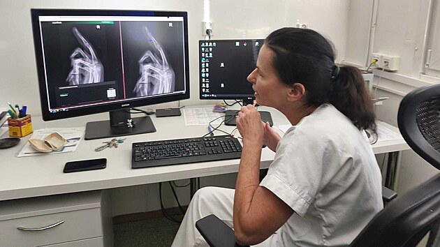 Primářka RDG oddělení Nemocnice AGEL Šternberk MUDr. Jindřiška Judasová vyhodnocuje RTG snímek s Carebotem. (18. listopadu 2025)