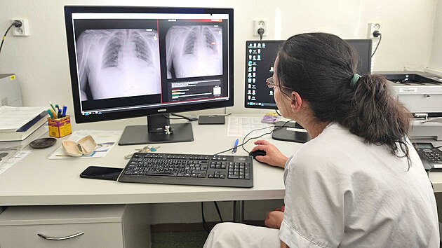 Primářka RDG oddělení Nemocnice AGEL Šternberk MUDr. Jindřiška Judasová vyhodnocuje RTG snímek s Carebotem. (18. listopadu 2025)